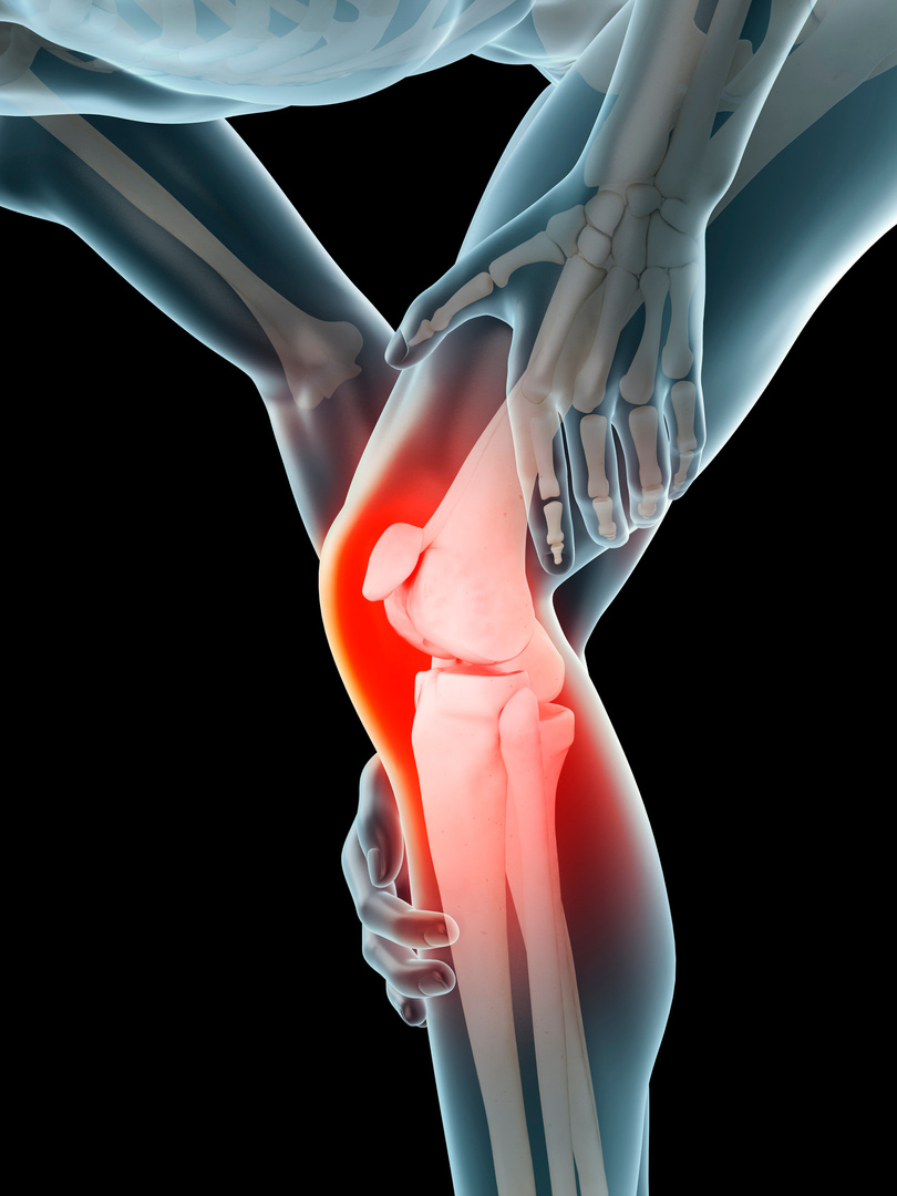 "Human knee pain